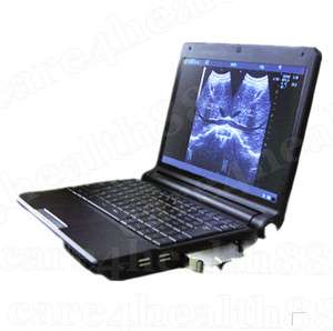 CE FUll Digital Laptop Ultrasound Scanner +Convex 9000F  